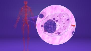 Myeloma cell and model of human skeleton